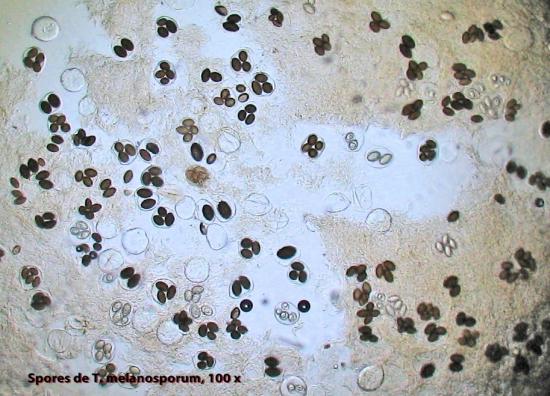 Spores de Tuber Melanosporum, Grossissement 100 X