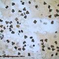 Spores de Tuber Melanosporum, Grossissement 100 X