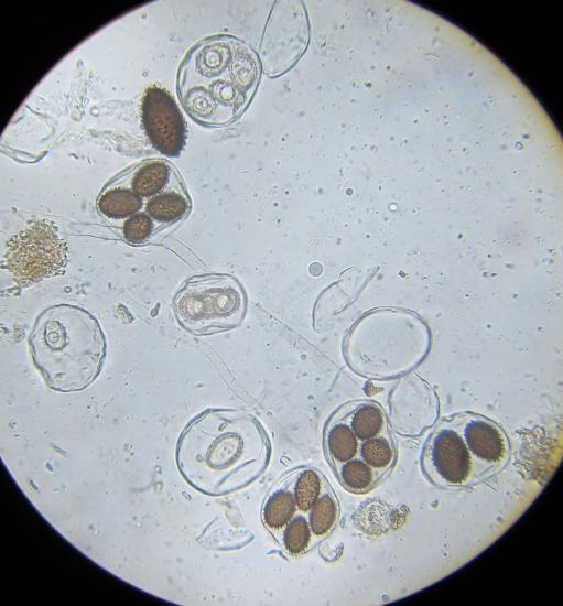 Spores de Tuber melanosporum