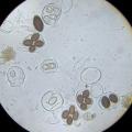 Spores de Tuber melanosporum